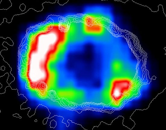 X-Ray Ring Around SN1987A